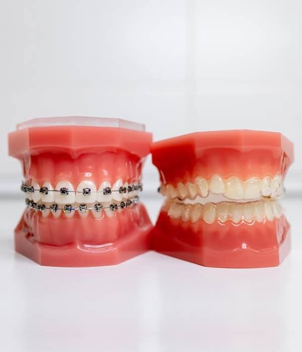 Braces and Orthodontics | Victoria, TX | Crossroads Dental of Victoria